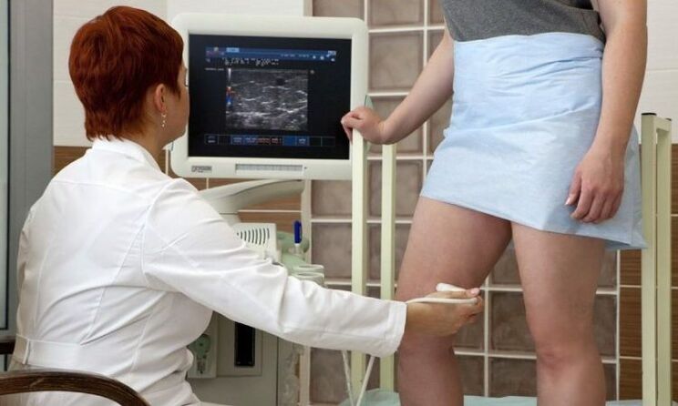 Laserska koagulacija za liječenje varikoznih vena