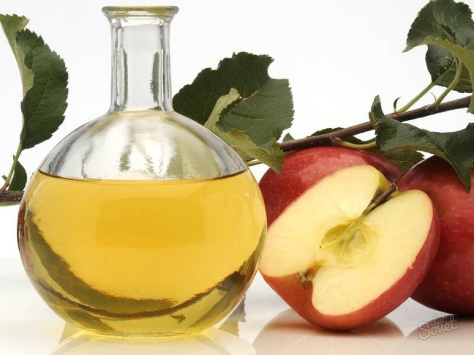 jabučni ocat za proširene vene